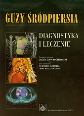 Guzy śródpiersia Diagnostyka i leczenieJacek Gawrychowski