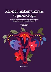 Podręcznik do nauki zabiegów laparoskopowych histeroskopowych,Jacek Doniec