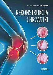 Rekonstrukcja chrząstkiBartłomiej Kacprzak