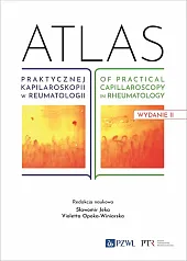 Atlas praktycznej kapilaroskopii w reumatologii. Atlas,Sławomir Jeka