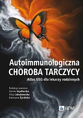 Autoimmunologiczna choroba tarczycyDorota Szydlarska