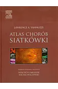Atlas chorób siatkówki