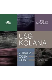 USG kolana