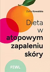 Dieta w atopowym zapaleniu skóry