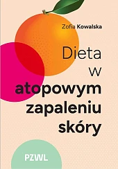 Dieta w atopowym zapaleniu skóryZofia Kowalska