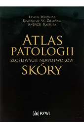 Atlas patologii złośliwych nowotworów skóry