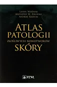 Atlas patologii złośliwych nowotworów skóry