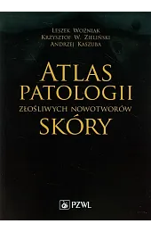 Atlas patologii złośliwych nowotworów skóryLeszek Woźniak