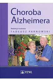 Choroba Alzheimera