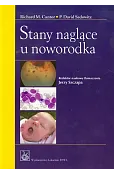 Stany naglące u noworodka