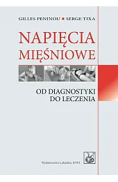 Napięcia mięśniowe