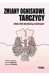 Zmiany ogniskowe tarczycy. Atlas USG dla lekarzy rodzinnych