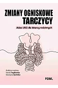 Zmiany ogniskowe tarczycy. Atlas USG dla lekarzy rodzinnych