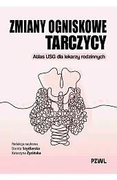Zmiany ogniskowe tarczycy. Atlas USG dla,Dorota Szydlarska
