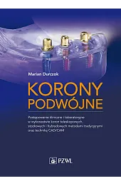 Korony podwójne. Postępowanie kliniczne i laboratoryjne w wykonastwie koron teleskopowych, stożkowyc