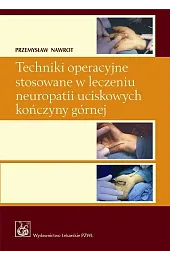 Techniki operacyjne stosowane w leczeniu neuropatii uciskowych kończyny górnej z płytą CD