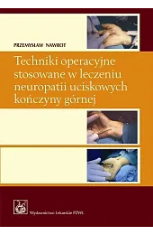 Techniki operacyjne stosowane w leczeniu neuropatii,Przemysław Nawrot