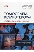 Tomografia komputerowa Zastosowanie kliniczne