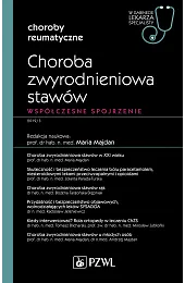 Choroba zwyrodnieniowa stawów. Współczesne spojrzenieMaria Majdan