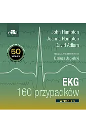 EKG 160 przypadków