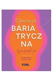 Operacja bariatryczna. Życie przed i po