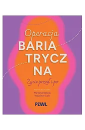 Operacja bariatryczna. Życie przed i poMarzena Sekuła