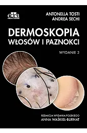 Dermoskopia włosów i paznokciSechi Andrea