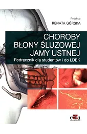 Choroby błony śluzowej jamy ustnej