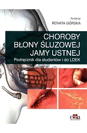 Choroby błony śluzowej jamy ustnej