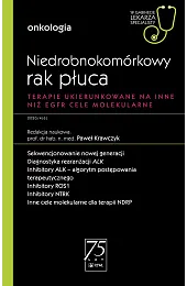 Niedrobnokomórkowy rak płucaPaweł Krawczyk