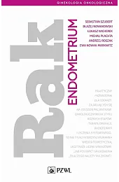Rak endometriumSebastian Szubert