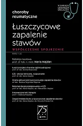 Łuszczycowe zapalenie stawówMaria Majdan