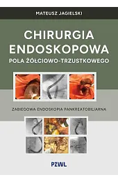 Chirurgia endoskopowa pola żółciowo-trzustkowego. Zabiegowa endoskopia pankreatobiliarna