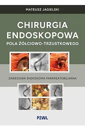 Chirurgia endoskopowa pola żółciowo-trzustkowego. Zabiegowa endoskopia,Mateusz Jagielski