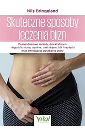 Skuteczne sposoby leczenia bliznBringeland Nils